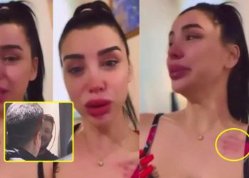 Aleyna Eroğlu, Batuhan Karadeniz’den şiddet gördüğünü iddia etti