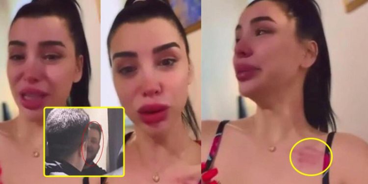 Aleyna Eroğlu, Batuhan Karadeniz’den şiddet gördüğünü iddia etti